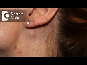 What causes swelling of lymph node near the ear in a young female? - Dr. Satish Babu K