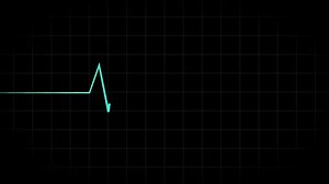 Animación Pulse Flatline. ECG, cardiograma, pantalla del cardiógrafo. Movimiento de línea de latido azul. Bucle de monitor de frecuencia cardíaca.