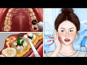 #asmr #asmrvideo #animation #PimplePopping #satisfying #asmrremove #viralfb #reels #fbreels #reelsfb #facebookreels #trendingreels #explorepage #likeforlike #viral #shorts #FacebookPage #facebookpost #foryou #trend #viralvideo #viralfb #fblifestyle #TeethCare #teethwhitening #teethcleaning #teething | Gentle Asmr Animation