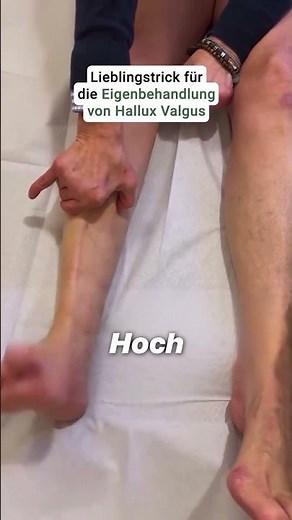 Der Hallux Valgus entsteht oft nicht nur durch Fehlstellung, sondern auch durch verklebte Faszien im