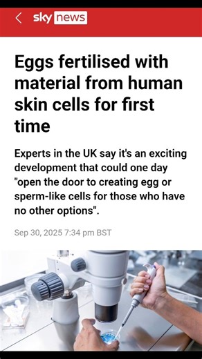 standup.x on Instagram: "It could one day lead to the creation of egg or sperm-like cells for people who are struggling to conceive. The emerging process is called in vitro gametogenesis (IVG) and involves reprogramming skin cells to make them a type of stem cell. Researchers say it has "immense therapeutic potential" for people who don't have viable sperm or eggs. It works by taking the nucleus - the part of the cell that stores the genetic material - from a person's skin cells. These are then 