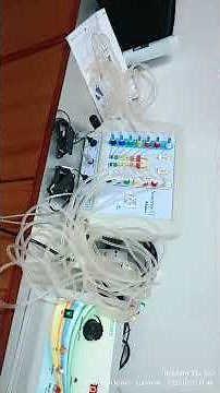 how to operate XT14 fully automatic ABI TBI Doppler test of diabetic patient