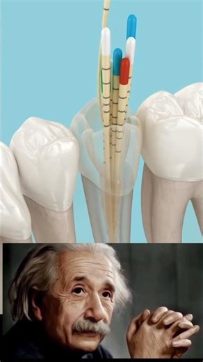 Dental root canal filling process.
