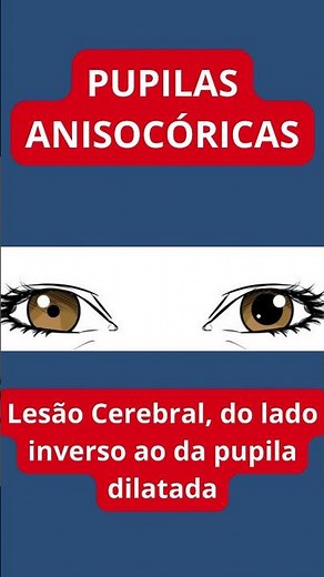 The Secret of the Pupils: What do anisocoria, mydriasis, and miosis reveal?