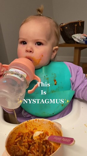 Nystagmus Eyes: Understanding Involuntary Eye Movements