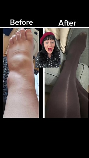 Our huggy tights are BACK and now available in 6 shades! Enjoy the benefits of light compression tights in Slate, Navy, Caramel Latte, Hot Chocolate and Builders Tea plus the OG Classic Black! We were blown away by the response to these when we first trialled them. If you are on your feet all day then these are the tights for you. Our unique knitting structure has been specifically built with tension to provide light compression to give your legs some extra support. Designed to help keep the cir