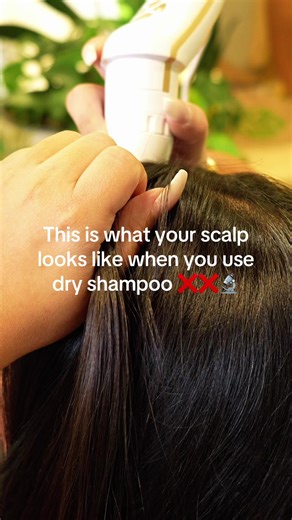 Understanding Dry Shampoo Effects on Scalp Health