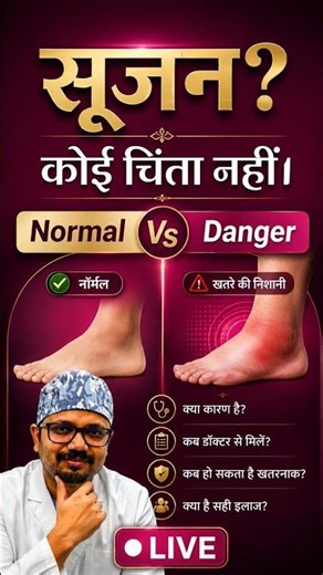 Swollen feet after prolonged standing or travel? Don't panic, learn which swelling is 'safe' | CWC