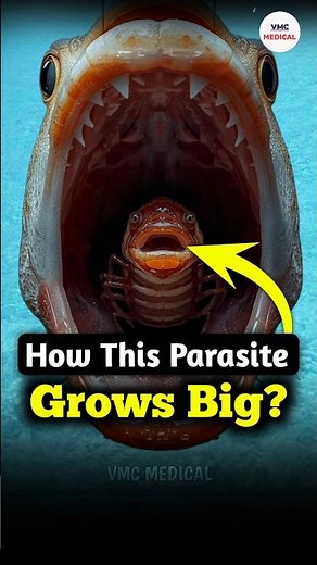 How Toung Eating Louse grow so big by VMC Medical