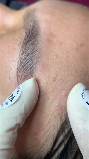 Êm ru#chamsocdamun#chamsocdaseo#chamsocdanam#tanbinh#Lqspa&academy