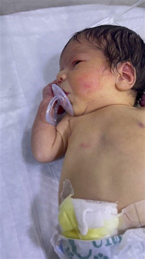 Baby with pacifier | feeding tips #baby