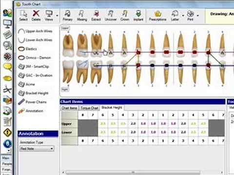 Dolphin Management Tooth Chart Overview