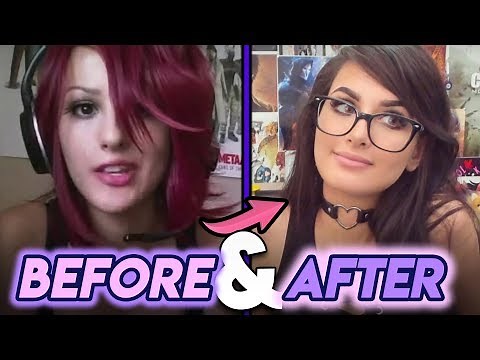 Sssniperwolf | Before and After | Plastic Surgery Rumours & Transformation