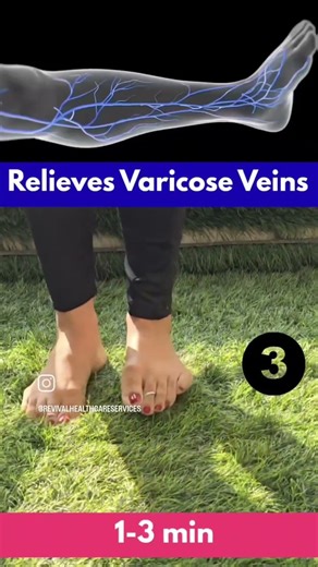 5 Physiotherapy Exercises for Varicose Veins | Improve Blood Circulation & Reduce Leg Pain