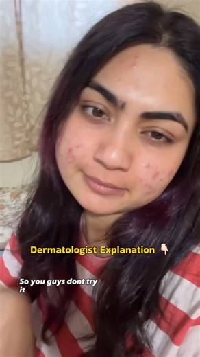 Dr. Reena Sharma on Instagram: "Is Slugging Good or Bad for Your Face? Slugging is a skincare trend where a thick occlusive like petroleum jelly is applied as the last step at night to seal in moisture. It works by locking water into the skin and preventing overnight moisture loss. So, is Vaseline good for your face? The answer depends on your skin type. Vaseline itself is non-comedogenic, meaning it does not clog pores on its own. For very dry, compromised, or sensitive skin, slugging can help