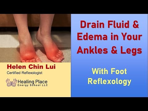 Drain Fluid & Edema in Your Ankles & Legs with Foot Reflexology