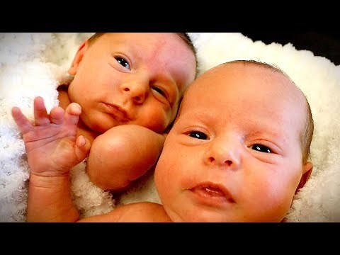 PREEMIE TWINS! (Cuteness Overload) | Dr. Paul
