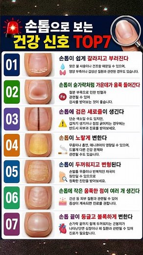 🚨 손톱으로 보는 건강 신호 TOP7 #건강정보 #손톱 #건강상식