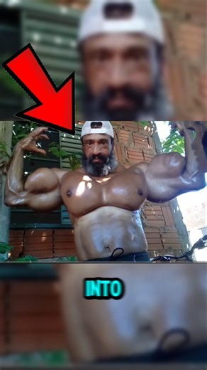 This man injected oil into his muscles on PURPOSE! 😲