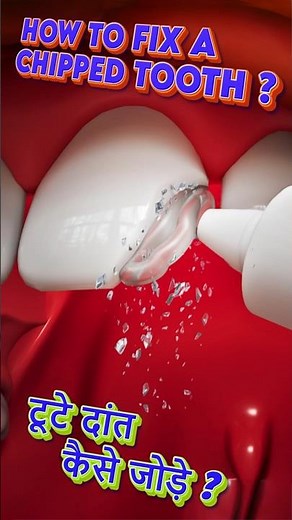 How to Fix a Chipped Tooth (Step by Step Guide 3D Animation) #asmr #facts #science #howto #trending