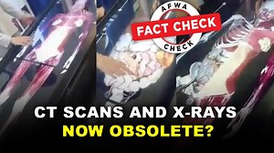 Fact Check: This ‘not-so-new’ technology will not replace CT scans and x-rays, it was made using them