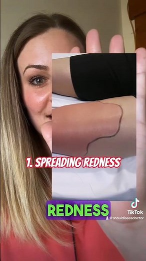 7 Warning Signs of A Serious Skin Infection (When it’s More Than Just A Bug Bite)