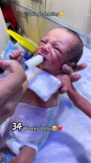 34 weeks premature NICU baby syringe feeding🥹💫😇 #BreastFeedBaby #tinynewbornbabies #foryo #viral #pleasetiktokteamviralvideo💯
