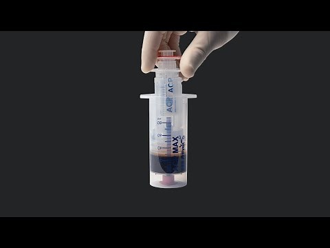 Creating PRP With the ACP Max™ PRP System