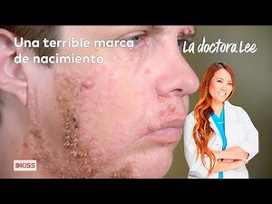 La doctora Lee prueba un nuevo tratamiento | La doctora Lee