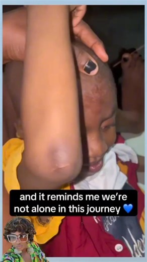 9K views · 95 reactions | A behaviour like SIB, or self injurious behaviour, is indeed prevalent among some autistic children, and witnessing your child inflict harm on themselves is heart-wrenching , yet autism embodies a journey of resilience, hope, and unyielding bravery to overcome.輸 #autismawareness #communitysupport #autismcommunity #autismacceptance #onlinecommunity | Life of an autistic mum | Facebook