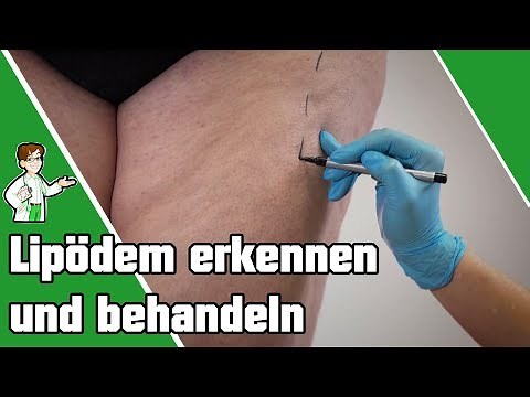 Lipödem erkennen und behandeln ❗️