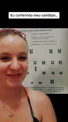 Exame de Cariótipo e Translocação Robertsoniana