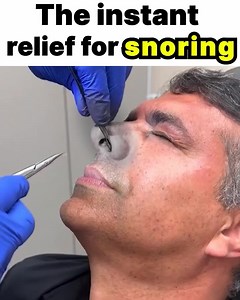 Snoring so loud it wakes the neighbors? 😨 Here’s the truth: nose strips and fancy pillows won’t help. The real culprit? A hidden muscle in your throat. But don’t worry—fixing it is easier than you think. 👉 Watch the video to discover how to shut down your snoring for good! | Sleep Silent