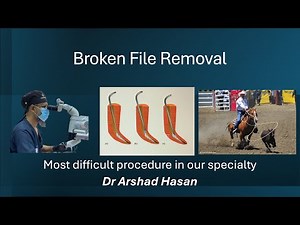 Broken File Removal Complete Guide