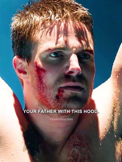 Oliver wears the hood in honor of his father.