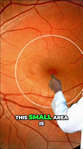 Macular of the eye #maculardegeneration #macular #eye #vision