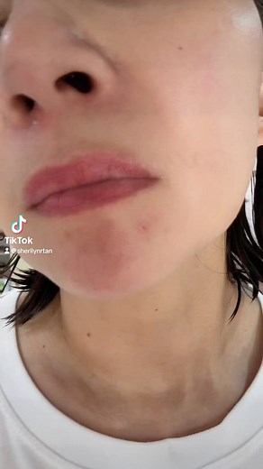 For acne, pimples, blackheads, aging skin, dry skin… lahat ng skin issues… this may be the solution for you!!!!! @beautedermcorporation | Tanfam Live Network