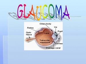 PPT - GLAUCOMA PowerPoint Presentation, free download - ID:875033