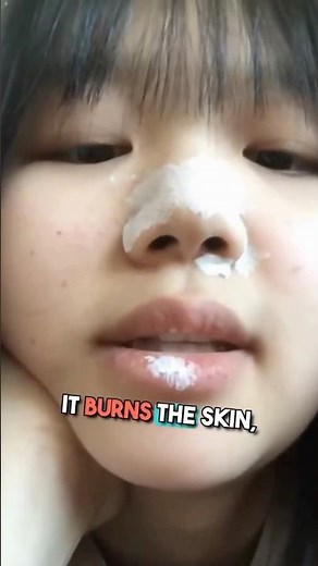 Why Toothpaste On Pimples Makes Them Worse