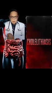 BATO SA APDO ( Cholelithiasis) #reelsviralシ #fypシ゚ #gallstones #cholelithiasis #batosaapdo #prevention #docROB | Robert Navalta