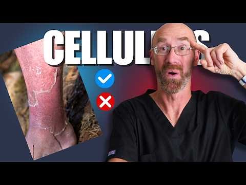 This Skin INFECTION Can Really Be Dangerous- Doctor Explains