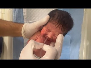 How to Pass an NG Tube in a Neonate | Step-by-Step NICU Nursing Procedure