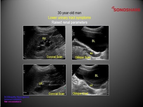 Image to Diagnosis – General sonography – Urinary Tract 3