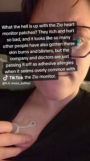 Zio Heart Monitor: Skin Reactions and Concerns