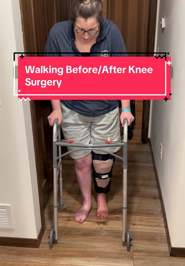 Knee Surgery Recovery Journey of an Ambulatory Paraplegic