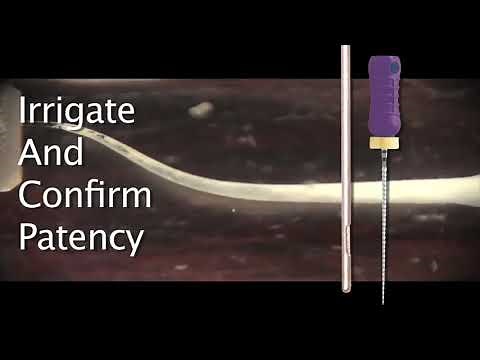 WaveOne Endodontic Rotary Files - DENTBEAR