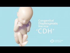 CDH Part 1: What is Congenital Diaphragmatic Hernia?