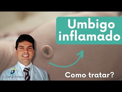 Umbigo do bebê inflamado ou granuloma umbilical: como tratar?