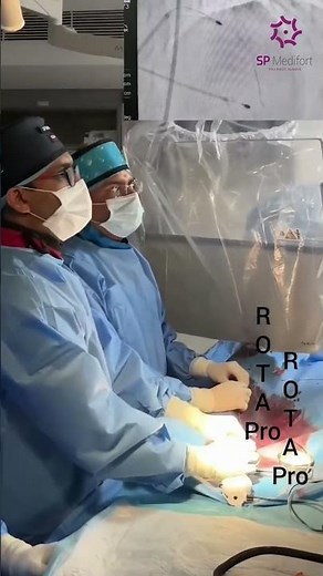 SP Medifort Hospital saves life of heart patient with advanced rotablation.