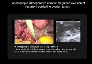 2.3K views · 62 reactions | New #UOGJournal video clip illustrating...